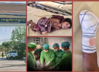 សូមកុំដាច់ចិត្ត អាណិតណាស់ ក្មួយស្រី ឃុន កញ្ចនា រងគ្រោះនិងផ្លៃពូថៅ ដាច់ប្រអប់ជើង ពិការអស់មួយជីវិត