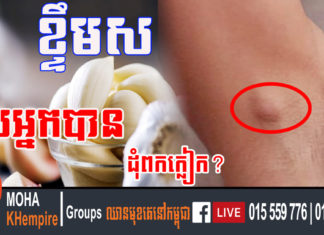 បញ្ហាដុំពកក្លៀក? ខ្ទឹមស, ក្រូចឆ្មារ និងគន្លឹះ ៤នេះជួយបាន ឈប់បារម្ភទៀតទៅ!