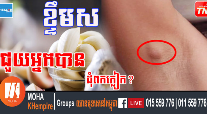 បញ្ហាដុំពកក្លៀក? ខ្ទឹមស, ក្រូចឆ្មារ និងគន្លឹះ ៤នេះជួយបាន ឈប់បារម្ភទៀតទៅ!